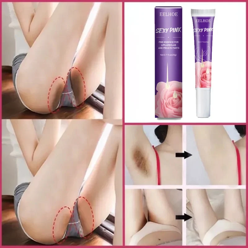 7days Whitening Cream Intimate Part Body Knees Elbows Neck Remove Dull Pigments Dark Spot Corrector Brighten Even Tone Skin Care
7days Whitening Cream Intimate Part Body Knees Elbows Neck Remove Dull Pigments Dark Spot Corrector Brighten Even Tone Skin Care