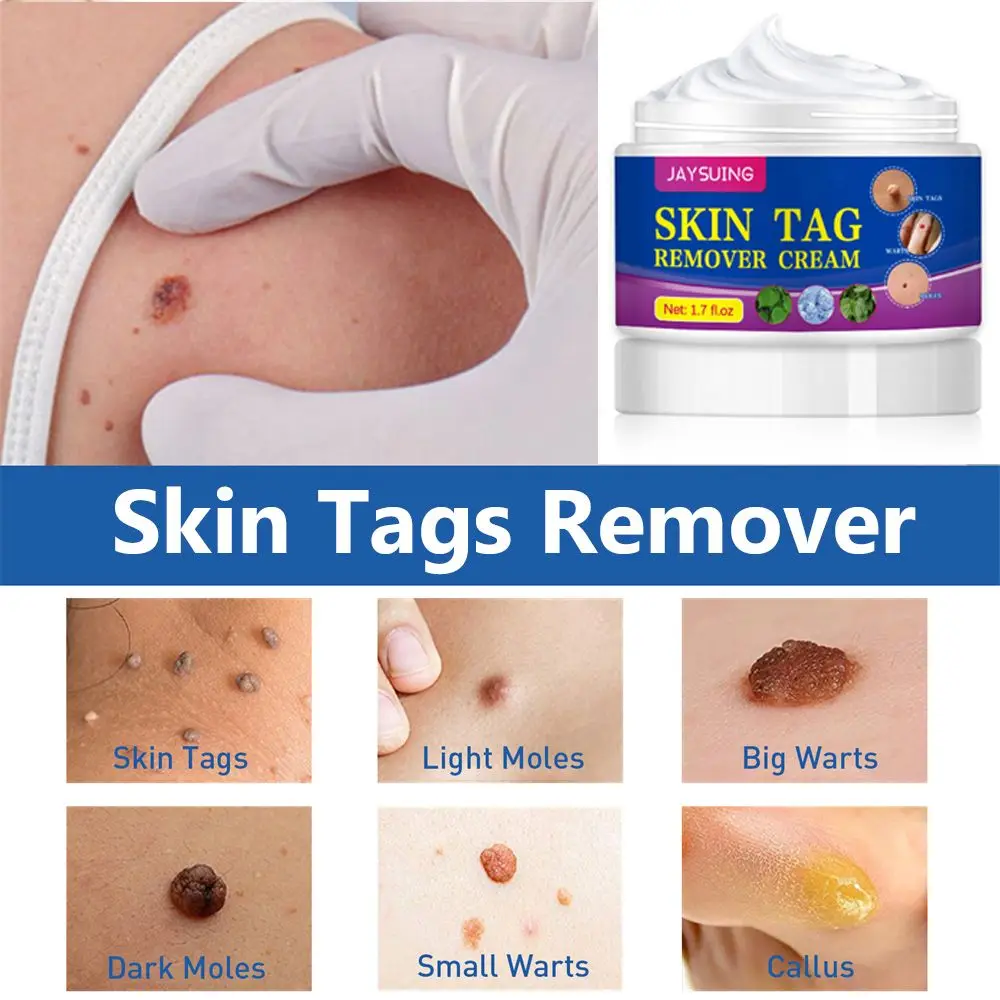 Unisex Skin Health Treatment Body Care Warts Remover Cream Anti Verruca Remedy Skin Tags Removal Removing Against Moles
Unisex Skin Health Treatment Body Care Warts Remover Cream Anti Verruca Remedy Skin Tags Removal Removing Against Moles