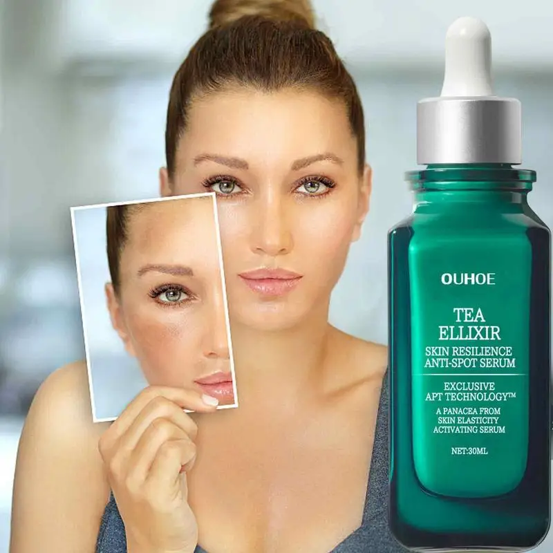 Dark Spot Corrector Facial Essence 30ml Skin Brighten Moisturize Hydrate Anti-Wrinkle Serum Oil-Control Skin Care Lotion Essence
Dark Spot Corrector Facial Essence 30ml Skin Brighten Moisturize Hydrate Anti-Wrinkle Serum Oil-Control Skin Care Lotion Essence
