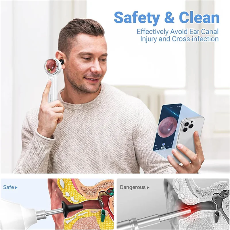 FORW Цифровой отоскоп с подсветкой
FORW Цифровой отоскоп с подсветкой