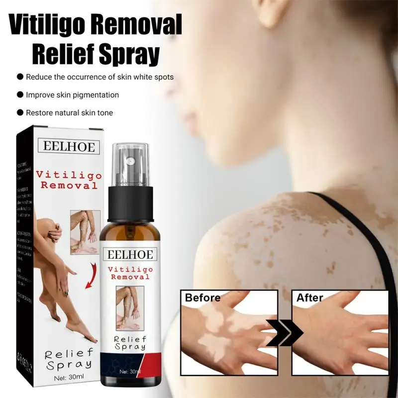 30ml Vitiligo Relief Spray Skin Moisturizing Vitiligo Net Spray Skin Repair Body Face Fades Vitiligo Spot Repair Body Care 1/2PC
30ml Vitiligo Relief Spray Skin Moisturizing Vitiligo Net Spray Skin Repair Body Face Fades Vitiligo Spot Repair Body Care 1/2PC