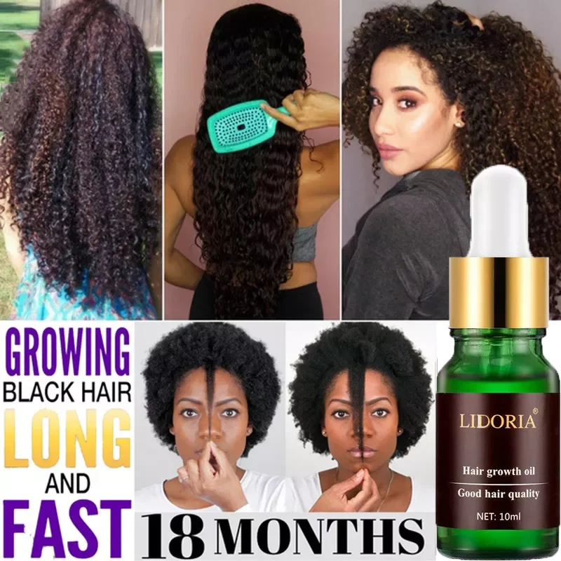 Fast Hair Growth Serum Natural Treatment Hair Loss for Thinning Hair Thickening and Reawakening Scalp Beauty Hair Growth Oil
Fast Hair Growth Serum Natural Treatment Hair Loss for Thinning Hair Thickening and Reawakening Scalp Beauty Hair Growth Oil