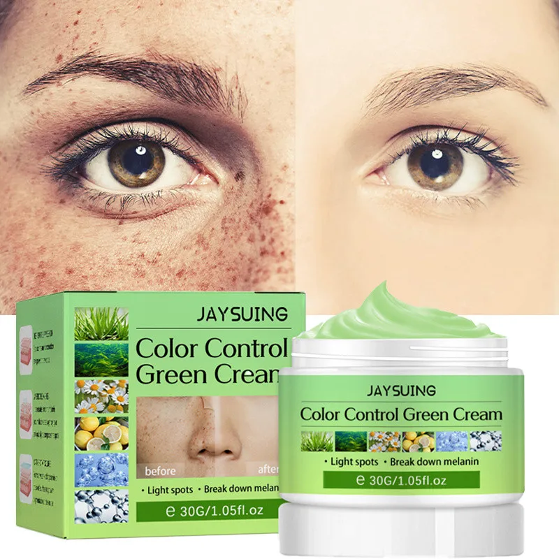 Nicotinamide Whitening Freckle Cream Fade Melanin Moisturizer Brighten Remove Melasma Dark Spot Anti-aging Skin Care Cosmetics
Nicotinamide Whitening Freckle Cream Fade Melanin Moisturizer Brighten Remove Melasma Dark Spot Anti-aging Skin Care Cosmetics