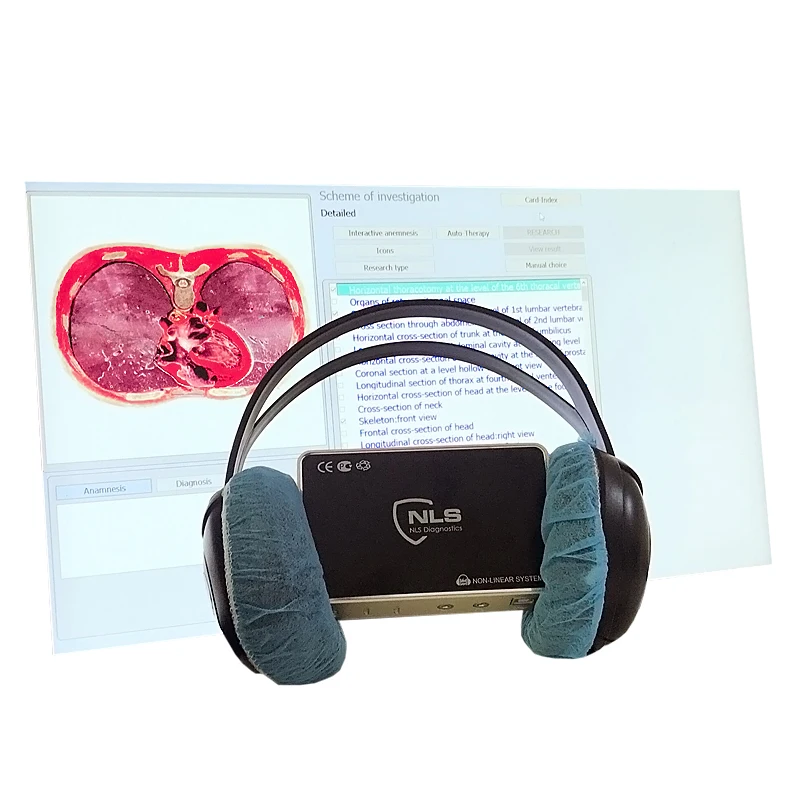 Supplier Body composition 9D NLS meter body element fat analyzer 9d German version hematology analyzer machine DHL free shipping
Supplier Body composition 9D NLS meter body element fat analyzer 9d German version hematology analyzer machine DHL free shipping