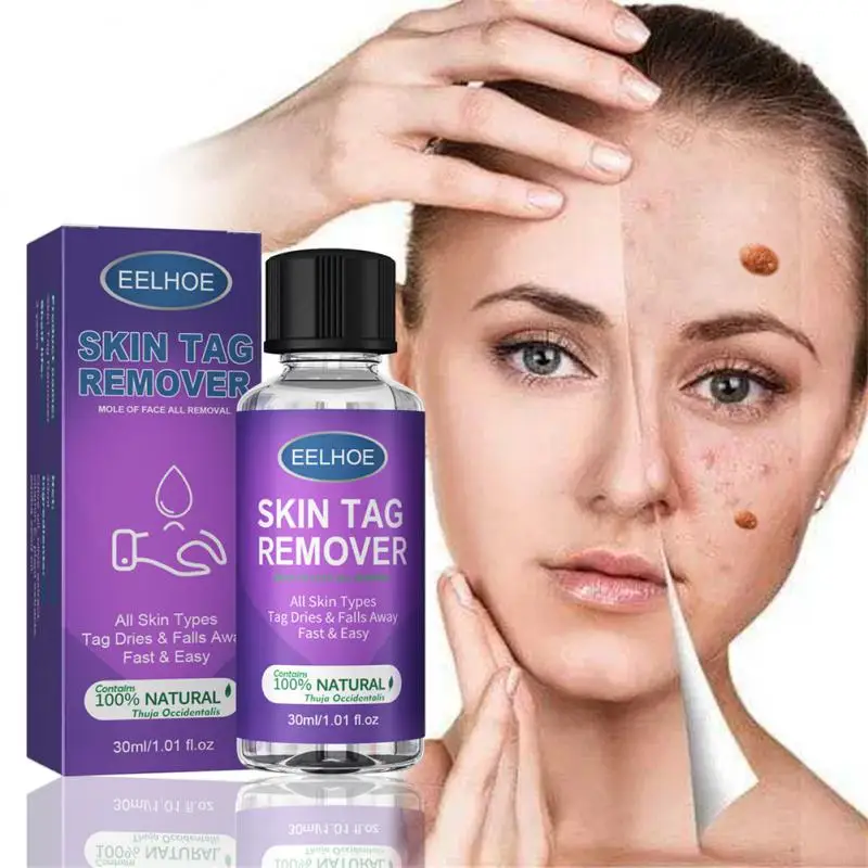Wart Remover Liquid Anti Verruca Remedy Liquid Quickly Remove Skin Wart And Mole Painless Skin Care Liquid Skin Tag Remover
Wart Remover Liquid Anti Verruca Remedy Liquid Quickly Remove Skin Wart And Mole Painless Skin Care Liquid Skin Tag Remover