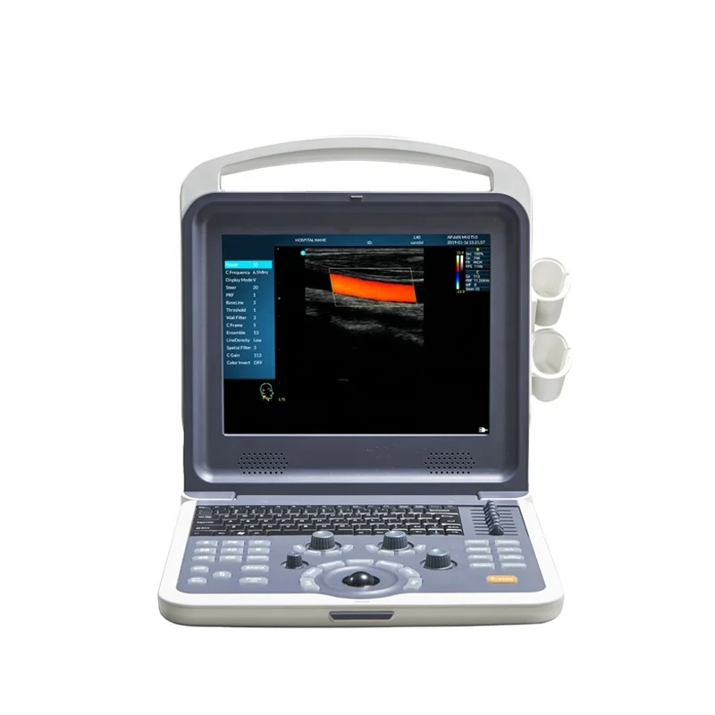 Multifuntional Six languages Cheap Ultrasound 4D scanne Machine Portable with Diagnostic 4D Technology
Multifuntional Six languages Cheap Ultrasound 4D scanne Machine Portable with Diagnostic 4D Technology