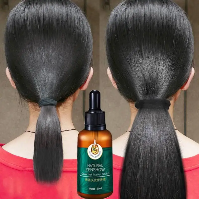 Rosemary Oil for Hair TRSTAY Ginger Hair Growth Essential Oil Herbal Care Anti-Hair Loss Repair Hair Follicles Stimulate
Rosemary Oil for Hair TRSTAY Ginger Hair Growth Essential Oil Herbal Care Anti-Hair Loss Repair Hair Follicles Stimulate