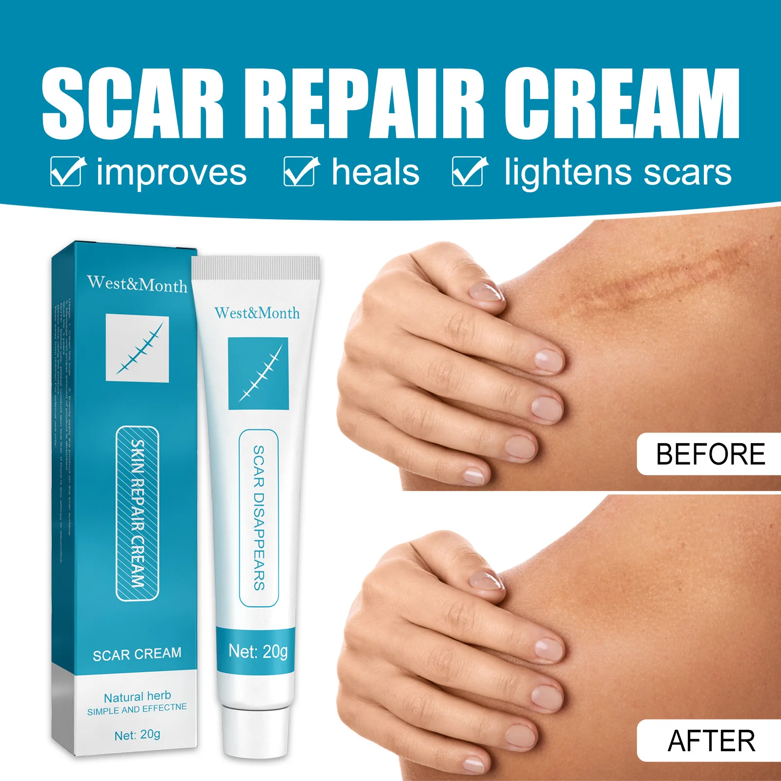 20g Scar Repair Cream Fades Pregnancy Surgery Burns Scald Skin Scar Removal Treatment Cream Pigmentation Corrector Dropshipping
20g Scar Repair Cream Fades Pregnancy Surgery Burns Scald Skin Scar Removal Treatment Cream Pigmentation Corrector Dropshipping