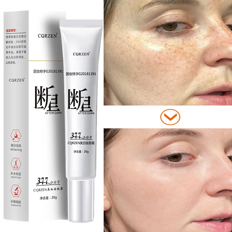 Fast Whitening Freckle Cream Removal Dark Spots Cream Inhibition Melanin Improve Dullness Brighten Moisturizing Facial Skin Care
Fast Whitening Freckle Cream Removal Dark Spots Cream Inhibition Melanin Improve Dullness Brighten Moisturizing Facial Skin Care