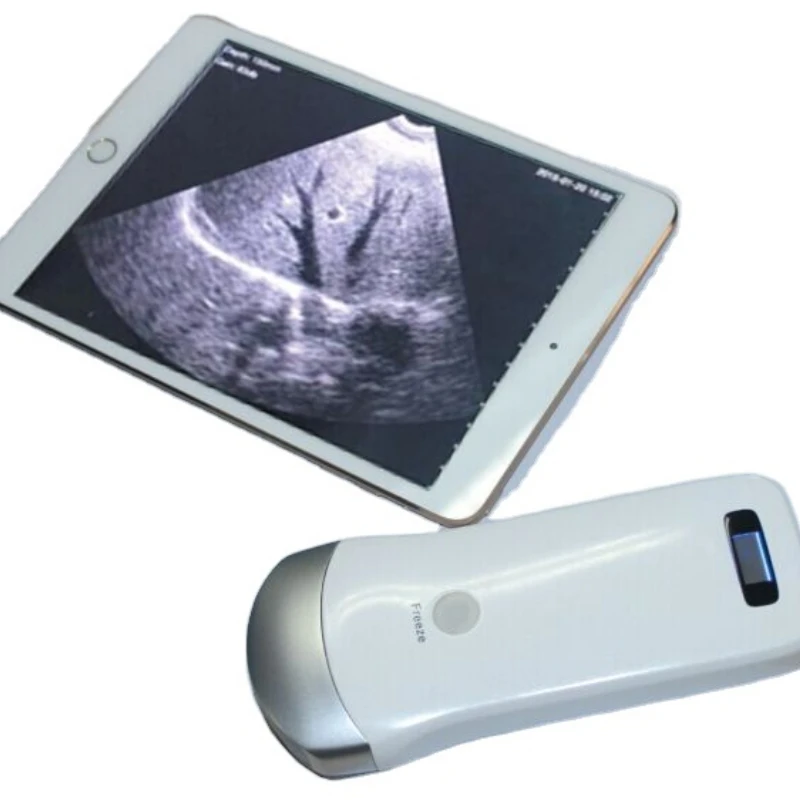 New Best Price Wireless convex/linear probe Wireless linear probe ultrasound machine work with phone/pad MSLPU35
New Best Price Wireless convex/linear probe Wireless linear probe ultrasound machine work with phone/pad MSLPU35