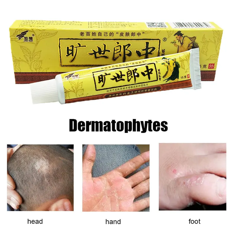 Dermatitis Anti Fungal Infection Psoriasis Eczema Cream Effective Treatment Fungus Foot Cream Dermatitis Itching
Dermatitis Anti Fungal Infection Psoriasis Eczema Cream Effective Treatment Fungus Foot Cream Dermatitis Itching