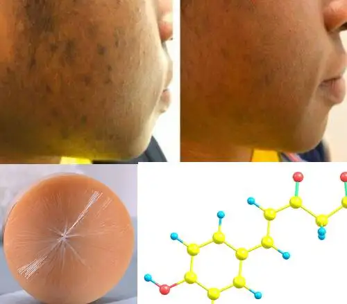 Осветляющая куркума и Медовое мыло, темная внутренняя поверхность бедра, Подмышечный оттенок кожи, зристая кожа, искусственная кожа
Осветляющая куркума и Медовое мыло, темная внутренняя поверхность бедра, Подмышечный оттенок кожи, зристая кожа, искусственная кожа