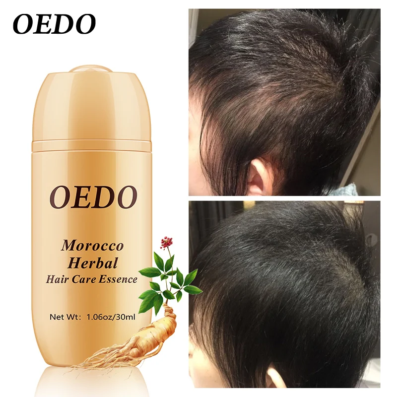 Hair Loss Repair Treatment Ginseng Ginger Hair Growth Oil Dry Hair Care Types Scalp Treatment Essence Keratin Hair Treatment
Hair Loss Repair Treatment Ginseng Ginger Hair Growth Oil Dry Hair Care Types Scalp Treatment Essence Keratin Hair Treatment