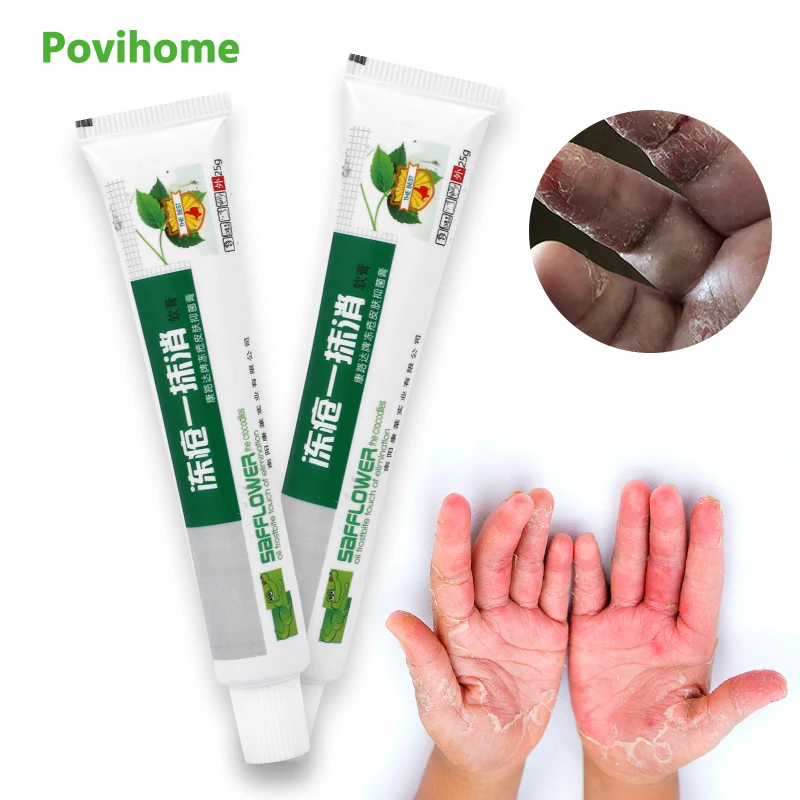 25G Anti Frostbite Cream for Skin Repair Cracked Ointment Frozen Protection Anti-Chapping Ointment Anti Dry Moisturize Cream
25G Anti Frostbite Cream for Skin Repair Cracked Ointment Frozen Protection Anti-Chapping Ointment Anti Dry Moisturize Cream