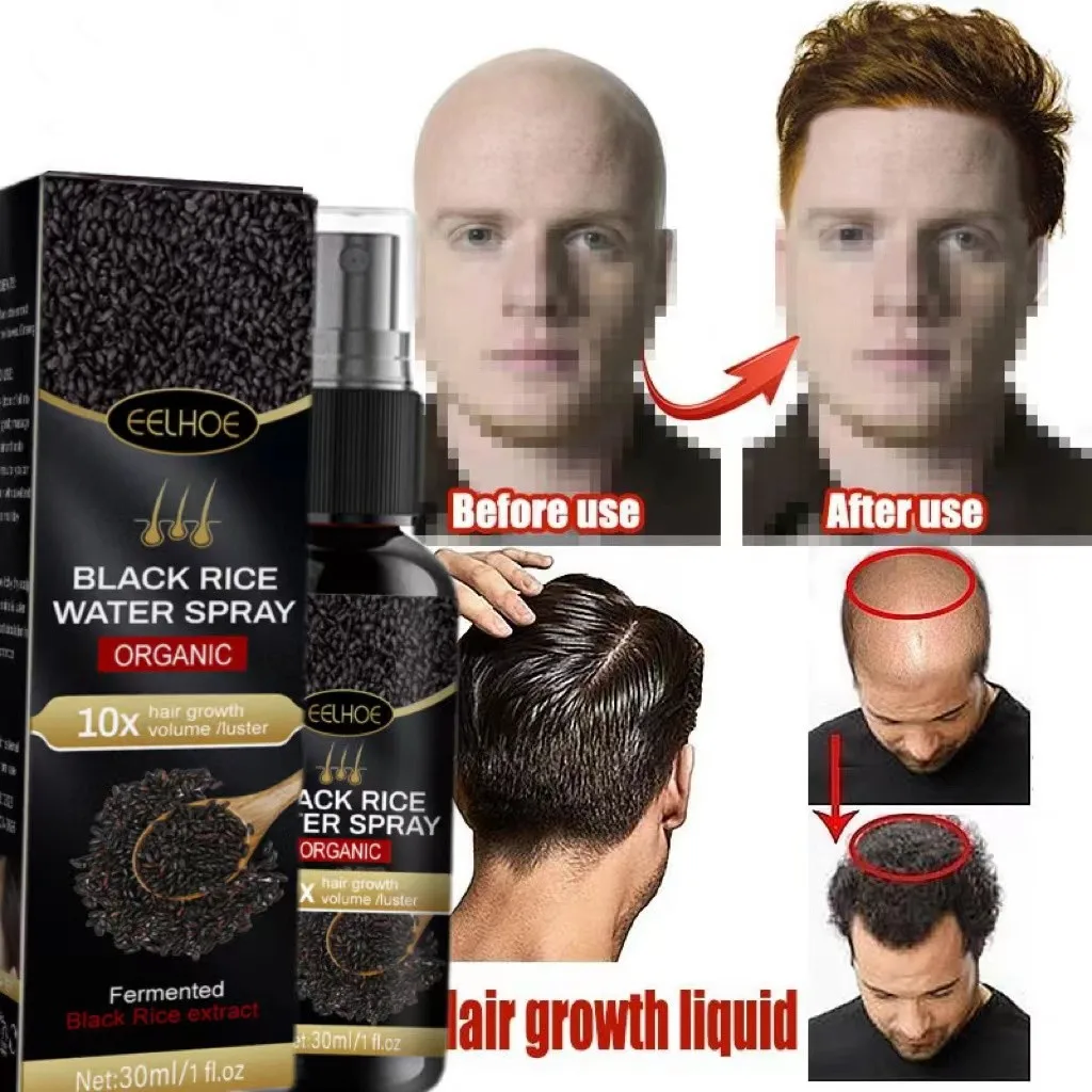 30ml Hair Growth Essence Natural Beauty Spray Professional Brazilian Keratin Oil For Black Women Prevent Hair From Falling Out
30ml Hair Growth Essence Natural Beauty Spray Professional Brazilian Keratin Oil For Black Women Prevent Hair From Falling Out