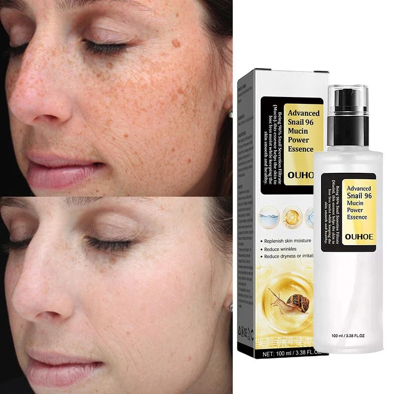 100ML Snail Mucin Collagen Serum Anti Wrinkle Face Lift Essence Blemish Dark Spot Remover Moisturizing Korean Skin Care Products
100ML Snail Mucin Collagen Serum Anti Wrinkle Face Lift Essence Blemish Dark Spot Remover Moisturizing Korean Skin Care Products