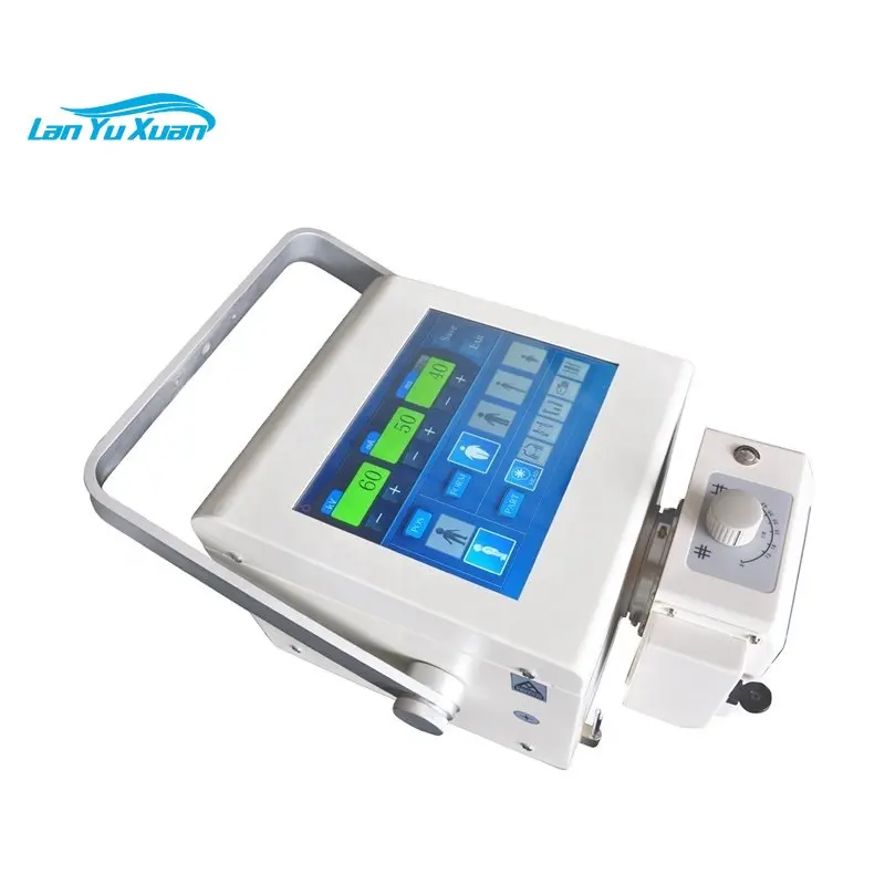 Hand Switch Chest Machine X-ray Portable Price in Hospital Room
Hand Switch Chest Machine X-ray Portable Price in Hospital Room