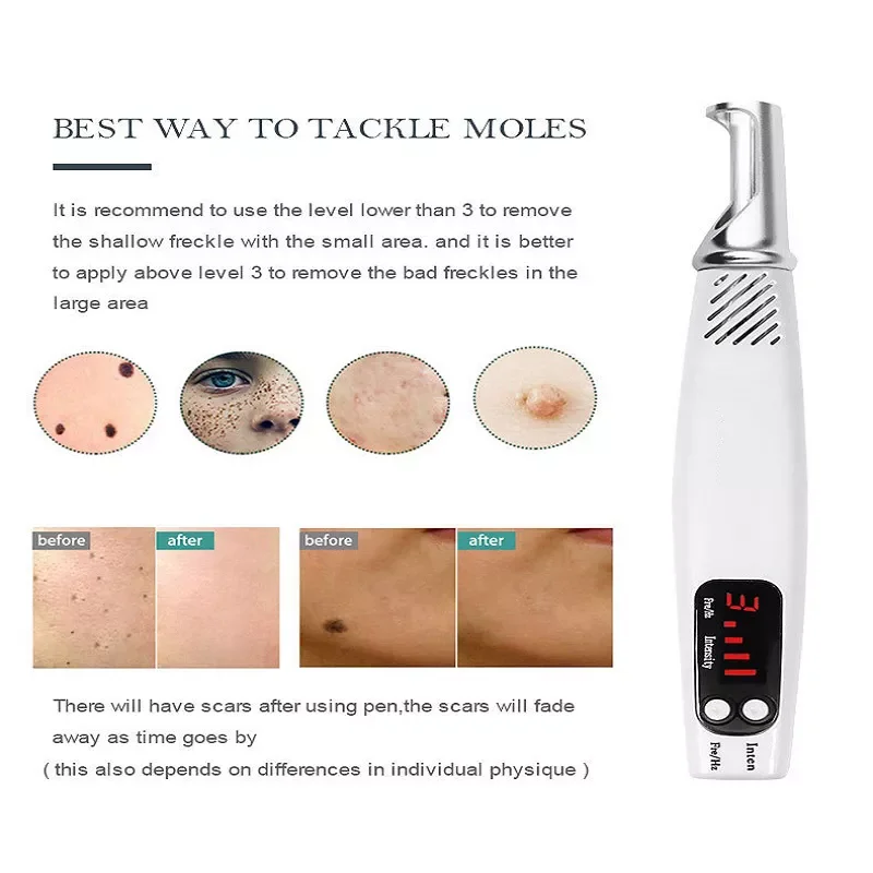 Picosecond Pen Skin Mole Scar Removal Dark Spot Remover Pen Acne Skin Pigment Remover Machin Laser Freckle Tattoo Removal Set
Picosecond Pen Skin Mole Scar Removal Dark Spot Remover Pen Acne Skin Pigment Remover Machin Laser Freckle Tattoo Removal Set