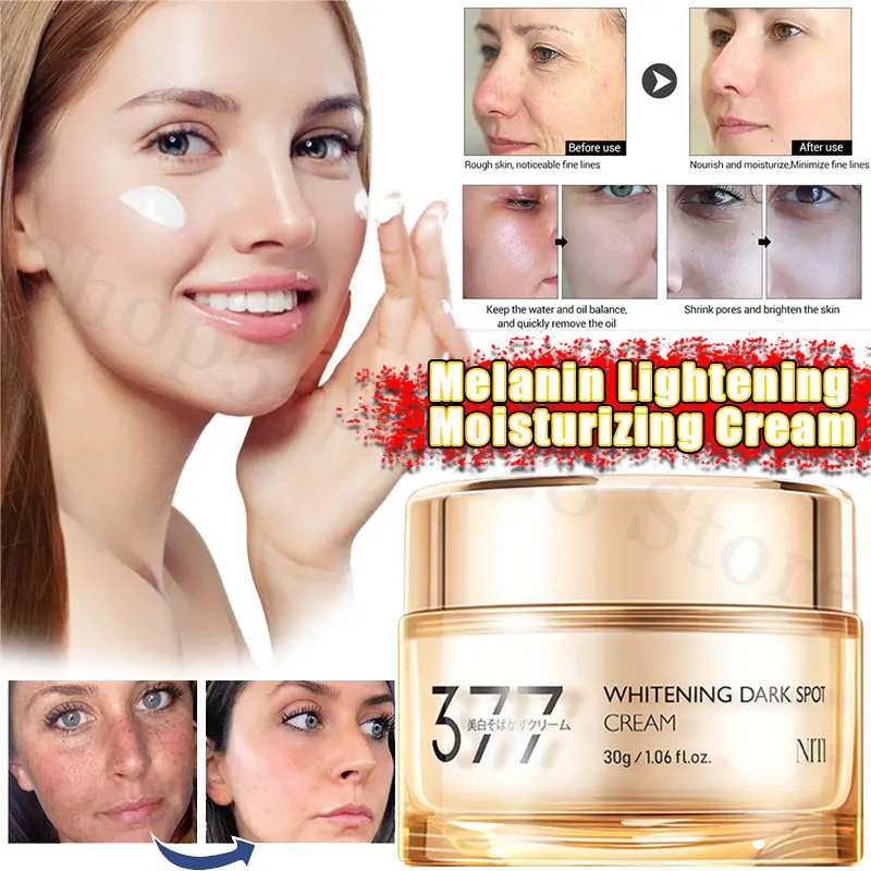 Niacinamide 377 Whitening and Anti-freckle Cream Brightens Skin Tone, Moisturizes and Lightens Dull Skin Face Cream Skin Care
Niacinamide 377 Whitening and Anti-freckle Cream Brightens Skin Tone, Moisturizes and Lightens Dull Skin Face Cream Skin Care