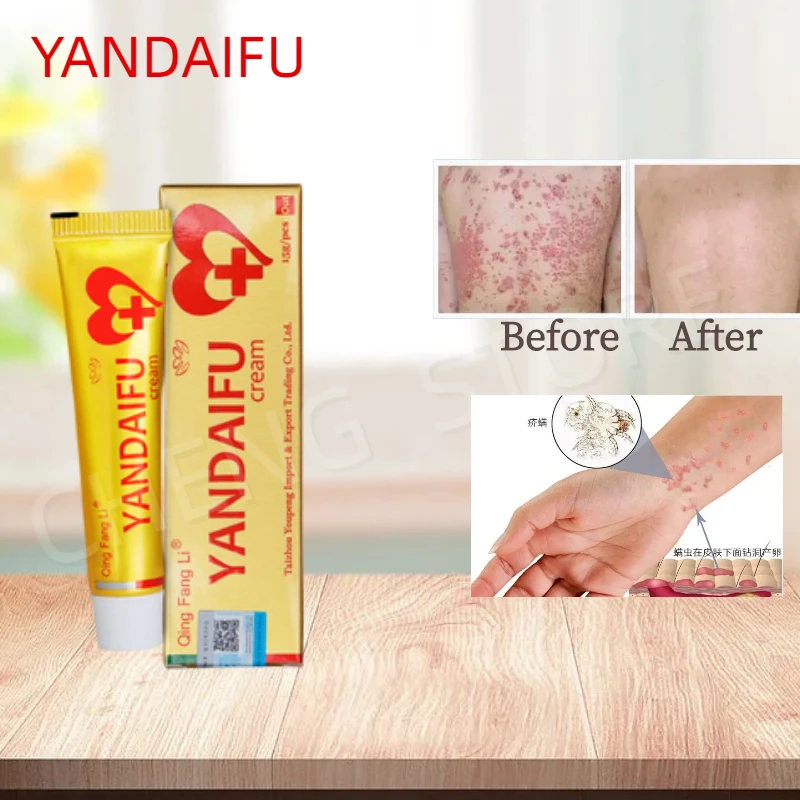 60pcs YIGANERJING YANDAIFU Body Cream Relieve Psoriasis Dermatitis Eczema Pruritus Effect Bacteriostasis and Antipruritic
60pcs YIGANERJING YANDAIFU Body Cream Relieve Psoriasis Dermatitis Eczema Pruritus Effect Bacteriostasis and Antipruritic