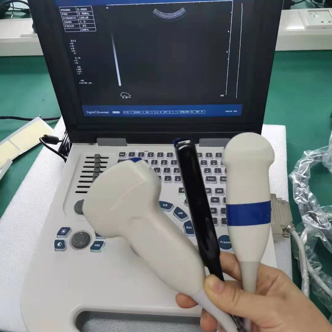 Original manufacturer Full Digital Black and White Portable Ultrasound Scanner factory price
Original manufacturer Full Digital Black and White Portable Ultrasound Scanner factory price