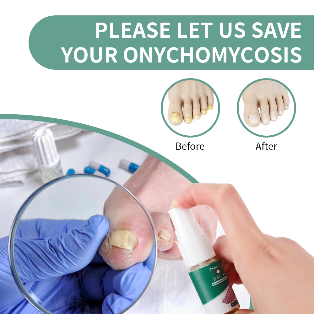 Nail Fungus Treatment Feet Care Essence Nails Foot Repair Toe Nail Fungal Removal Gel Anti Infection Paronychia Onychomycosis
Nail Fungus Treatment Feet Care Essence Nails Foot Repair Toe Nail Fungal Removal Gel Anti Infection Paronychia Onychomycosis