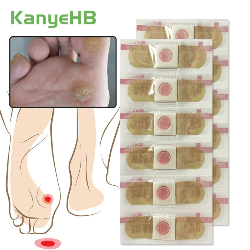 12Pcs Foot Corn Removal Patches Removal Warts Thorn Calluses Medical Detox Foot Care Stickers Skin Warts Remover Patches A291
12Pcs Foot Corn Removal Patches Removal Warts Thorn Calluses Medical Detox Foot Care Stickers Skin Warts Remover Patches A291