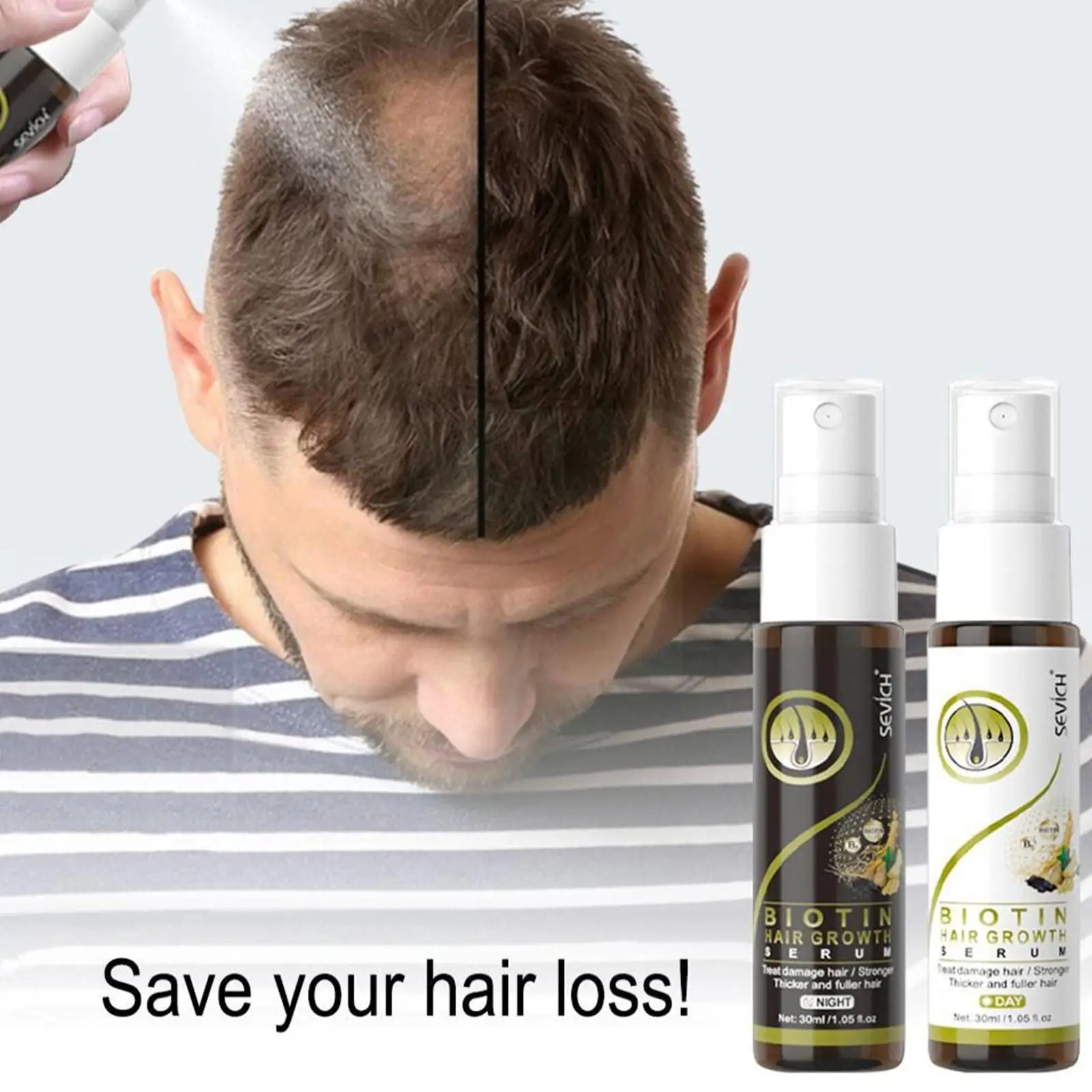 Biotin Hair Growth Serum Spray Ginger Hair Growth Anti Hair Loss Treatment Liquid Hair Spray For Hair Growthing Ginger Esse B8V1
Biotin Hair Growth Serum Spray Ginger Hair Growth Anti Hair Loss Treatment Liquid Hair Spray For Hair Growthing Ginger Esse B8V1