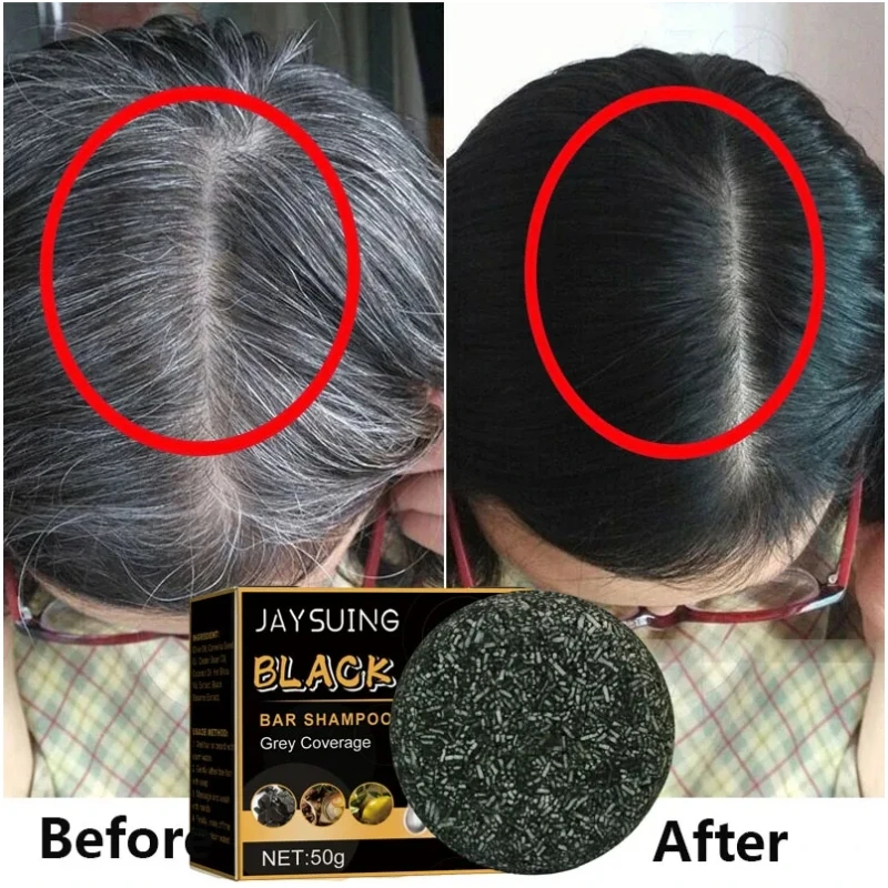 Effective White Hair Treatment Shampoo Bar Anti Gray Color Remedy Darken Hair Scalp Fast Regrowth Soap Anti-Loss Care Men Women
Effective White Hair Treatment Shampoo Bar Anti Gray Color Remedy Darken Hair Scalp Fast Regrowth Soap Anti-Loss Care Men Women