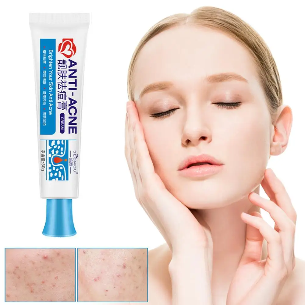 30g Powerful Acne Removal Face Cream Clears Pimple Severe Dots Pore Treat Gel Whiten Acne Shrink Skin Care Black Ointment S H8g4
30g Powerful Acne Removal Face Cream Clears Pimple Severe Dots Pore Treat Gel Whiten Acne Shrink Skin Care Black Ointment S H8g4