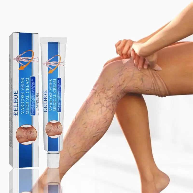 Крем от варикозного расширения вен, китайская травяная медицина, лечение раньше, спайдер, воспаление вен, массаж ног 
Крем от варикозного расширения вен, китайская травяная медицина, лечение раньше, спайдер, воспаление вен, массаж ног