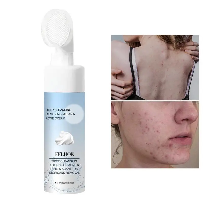 Natural Facial Cleanser Tree Oil Face Wash For Women Oily Skin Facial Cleansing Pore Cleaner Natural Hydrating Face Wash For
Natural Facial Cleanser Tree Oil Face Wash For Women Oily Skin Facial Cleansing Pore Cleaner Natural Hydrating Face Wash For