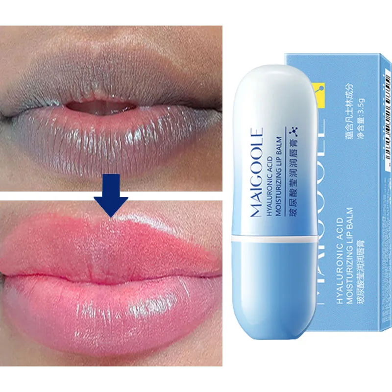 Hyaluronic Acid Remove Dark Lip Balm Whitening Moisturizing Cream Exfoliating Dead Skin Lighten Pigment Lip Care Beauty Health
Hyaluronic Acid Remove Dark Lip Balm Whitening Moisturizing Cream Exfoliating Dead Skin Lighten Pigment Lip Care Beauty Health