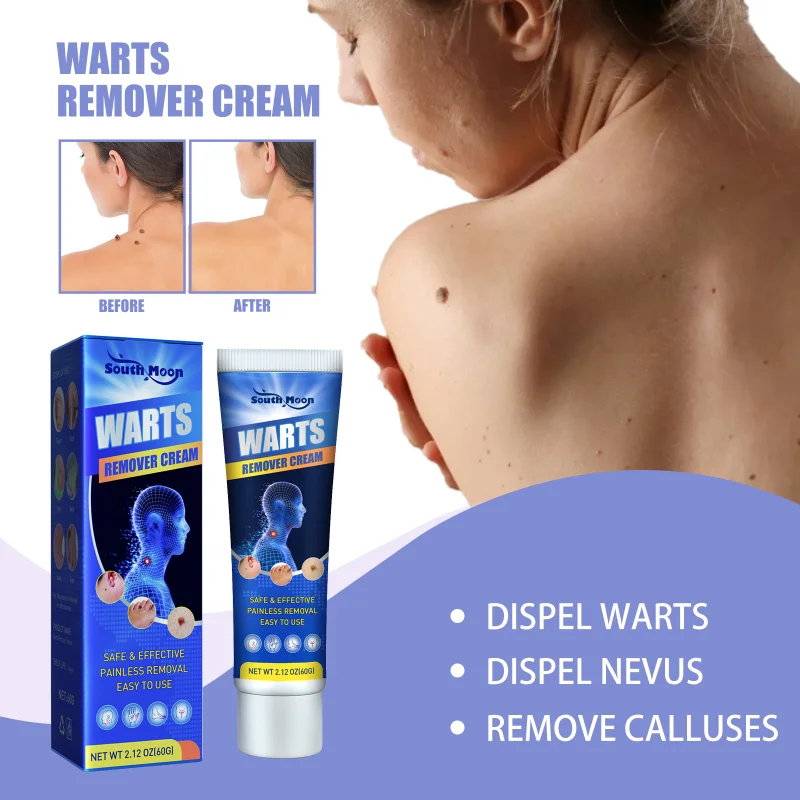 Wart Removal Ointment Antibacterial Cream Papillomas Mole Remedy Skin Tags Flat Genital Foot Corn Treatment Medical Plaster 60g
Wart Removal Ointment Antibacterial Cream Papillomas Mole Remedy Skin Tags Flat Genital Foot Corn Treatment Medical Plaster 60g