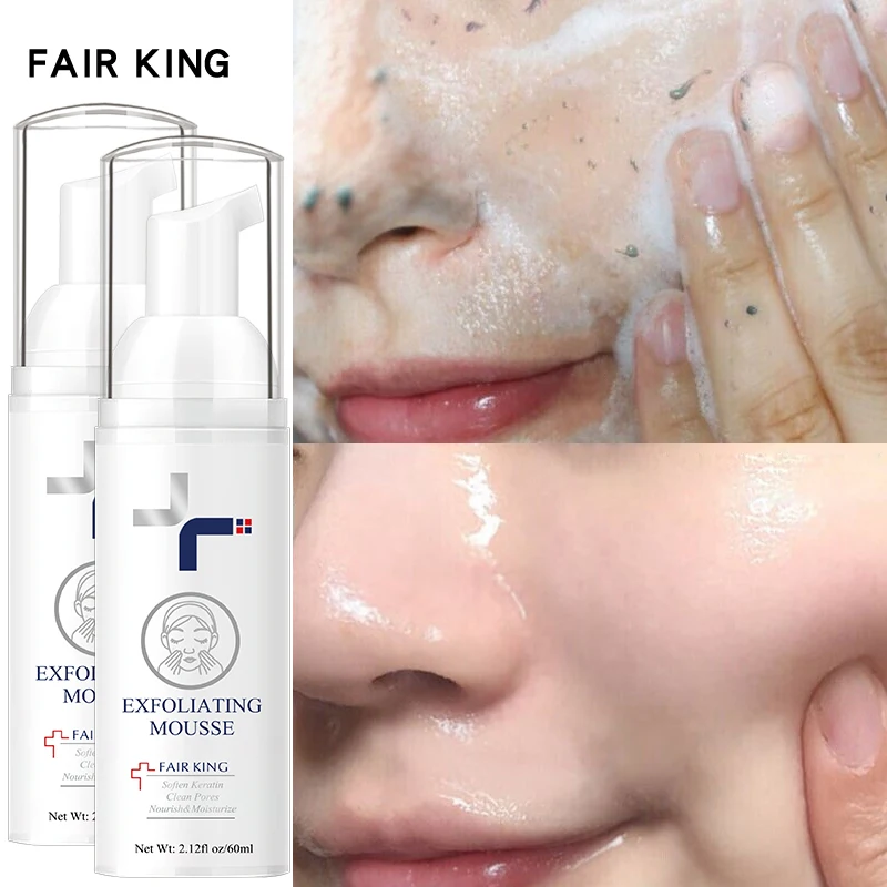 2PCS FAIR KING Exfoliating Scrub Deep Cleansing Cleansing All Skin Types Smoothing Moisturizing Exfoliating Cream
2PCS FAIR KING Exfoliating Scrub Deep Cleansing Cleansing All Skin Types Smoothing Moisturizing Exfoliating Cream