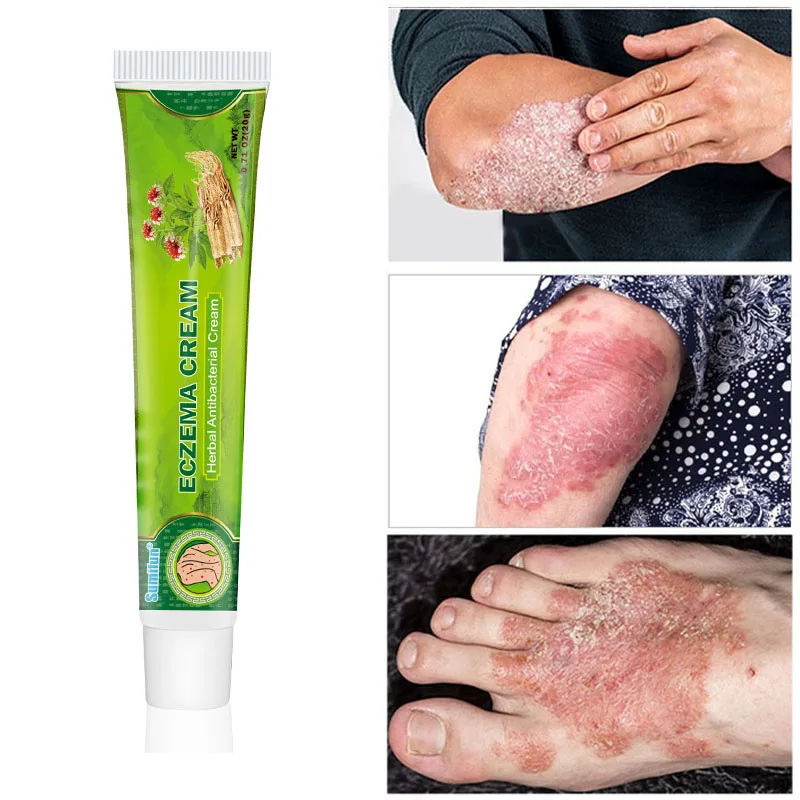 

Herbal Psoriasis Antibacterial Cream Anti-itch Dermatitis Eczema Urticaria Treatment Ointment Effective Anti Itching Body Care