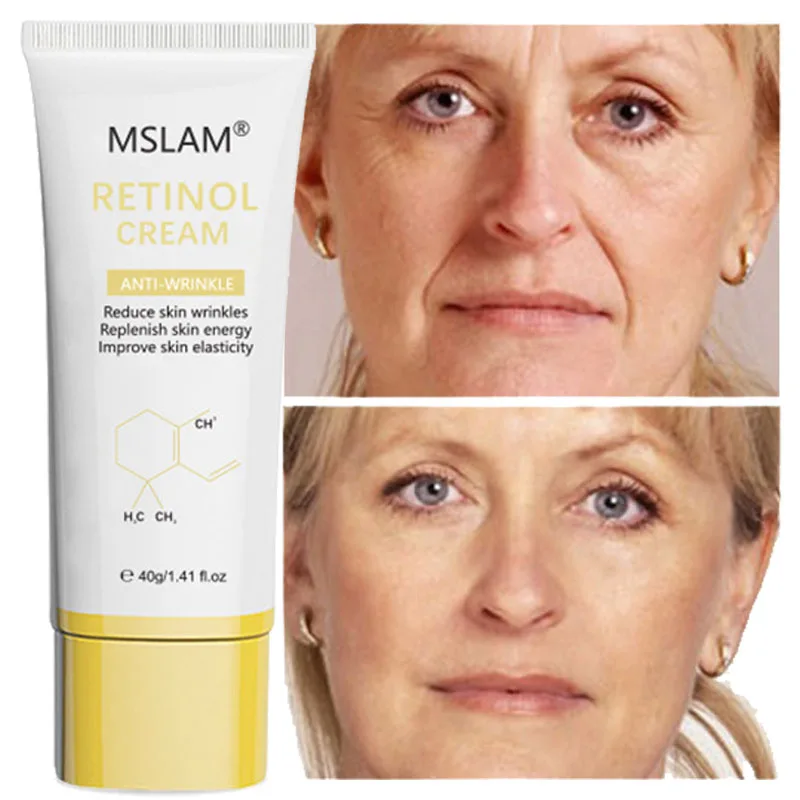 Retinol Face Whitening Cream For Dark Skin Anti Aging Anti-Wrinkle Fade Fine Lines Lifting Firming Cream Korean Skincare Product
Retinol Face Whitening Cream For Dark Skin Anti Aging Anti-Wrinkle Fade Fine Lines Lifting Firming Cream Korean Skincare Product