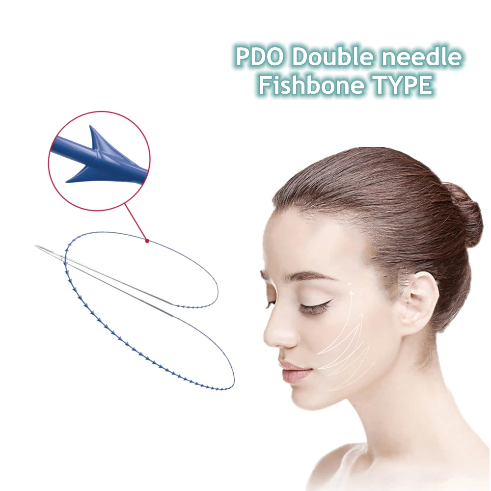 2022 PDO PCL thread lift Molding Pressing Threads Double needle pdo threads 20G290MM for face Body contouring
2022 PDO PCL thread lift Molding Pressing Threads Double needle pdo threads 20G290MM for face Body contouring