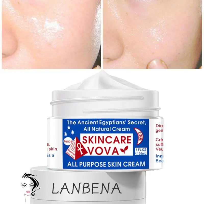 Powerful Whitening Cream To Remove Freckles Dark Sunburn Spots Face Skin Care Moisturizing Creams Beauty Cosmetic Moisturizer
Powerful Whitening Cream To Remove Freckles Dark Sunburn Spots Face Skin Care Moisturizing Creams Beauty Cosmetic Moisturizer
