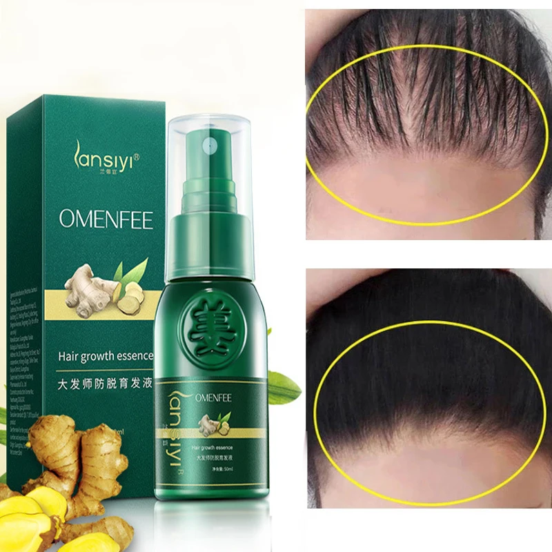 

Ginger Anti-hair Loss Hair Liquid Natural Plant Essence Fast Growth Beard Eyelash Hair Growth Spray Hair Loss Hair Care Essence