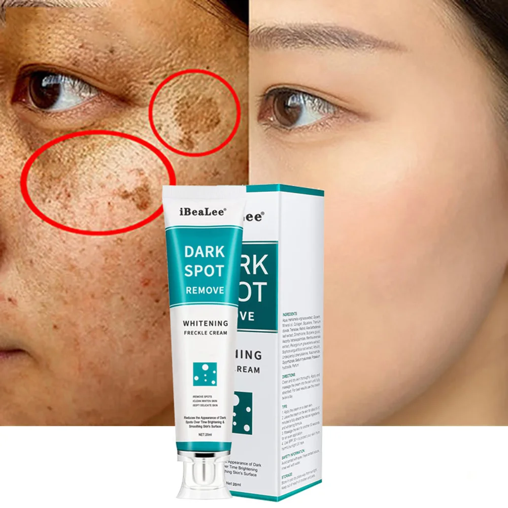 20g Whitening Freckle Cream Remove Melasma Acne Spot Pigment Melanin Dark Spots Whitening Moisturizing Cream Skin Care
20g Whitening Freckle Cream Remove Melasma Acne Spot Pigment Melanin Dark Spots Whitening Moisturizing Cream Skin Care