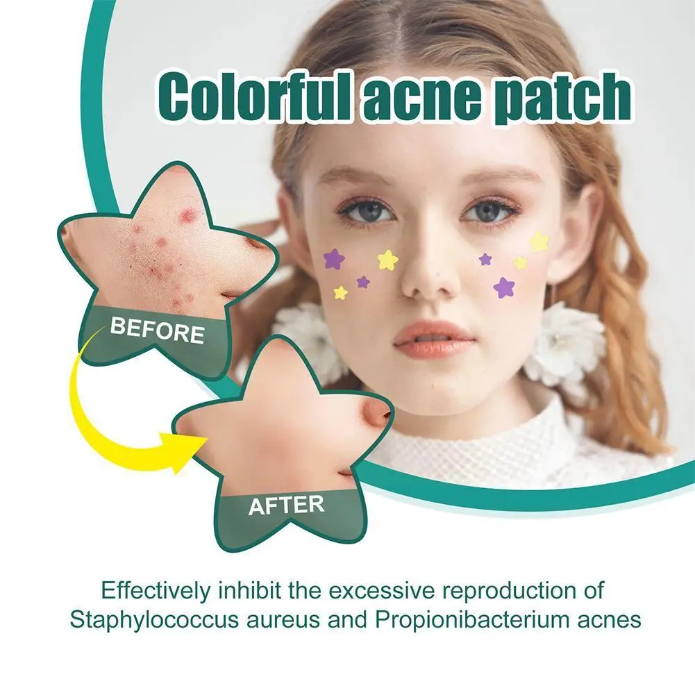 New Star Pimple Patch Stickers Dazzling Colorful Face Beauty Care Concealer Care Sticker Face Skin Removal Spot Makeup Acne L6Y3
New Star Pimple Patch Stickers Dazzling Colorful Face Beauty Care Concealer Care Sticker Face Skin Removal Spot Makeup Acne L6Y3