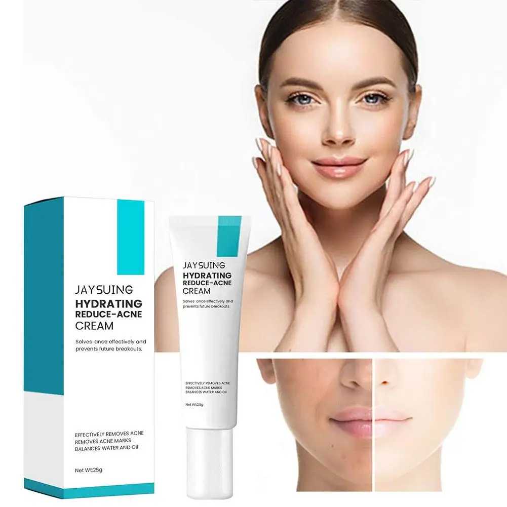 Acne Treatment Cream Moisturizing Control Oil Shrinking Remove Pores Pimple Product Removal Marks E8B2
Acne Treatment Cream Moisturizing Control Oil Shrinking Remove Pores Pimple Product Removal Marks E8B2