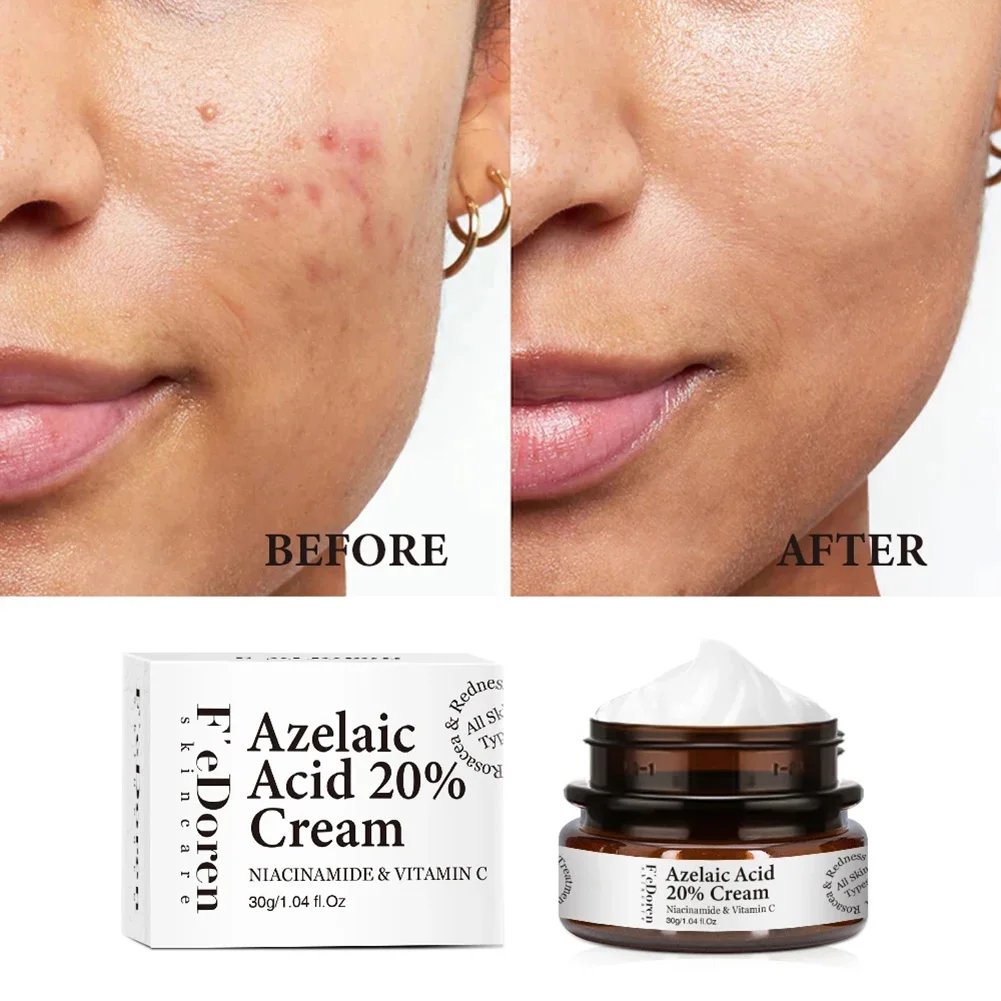 Azelaic Acid 20% Facial Cream Remove Dark Spots Acne Fine Lines Whiten Skin Face Moisturizing Cream Skin Care
Azelaic Acid 20% Facial Cream Remove Dark Spots Acne Fine Lines Whiten Skin Face Moisturizing Cream Skin Care