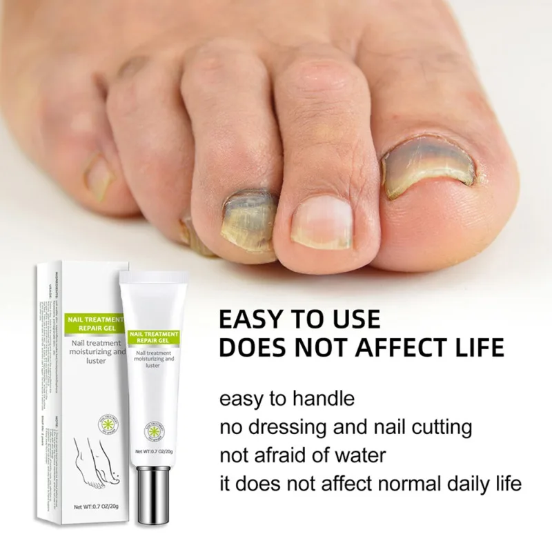 Увлажняющий блестящий гель для ногтей, 20 г
Увлажняющий блестящий гель для ногтей, 20 г