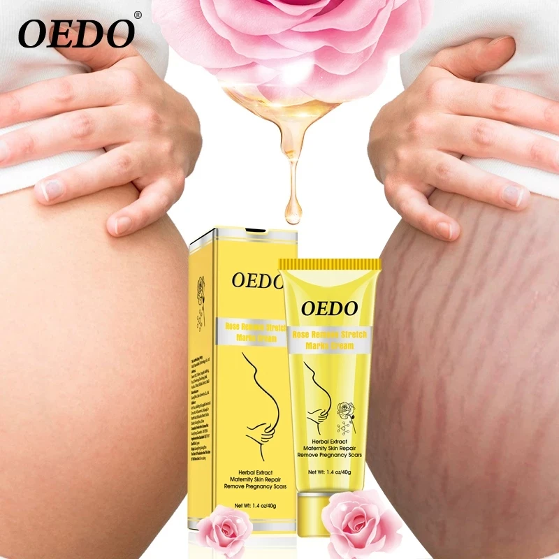 OEDO Rose Removes Stretch Mark Cream To Postpartum Obesity Pregnant Women Repair Anti-Aging Anti-Winkles Firming Body Cream
OEDO Rose Removes Stretch Mark Cream To Postpartum Obesity Pregnant Women Repair Anti-Aging Anti-Winkles Firming Body Cream