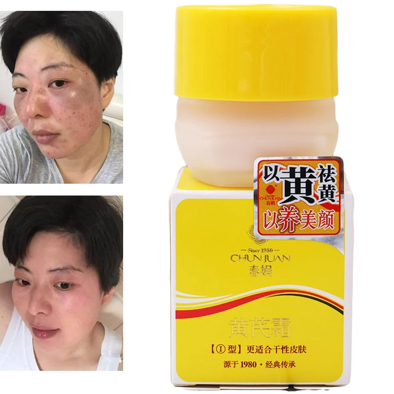 

Chinese Medicine Astragalus 20% Whitening Remove Dark Spots Facial Cream Repair Fade Freckls Melanin Remover Brighten Skin