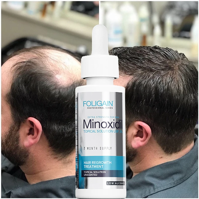 Hair Rapid Growth Spray for Men's Body and Chest and Eyebrows and Beard Thick Hair Treatment Loss Product 50ml
Hair Rapid Growth Spray for Men's Body and Chest and Eyebrows and Beard Thick Hair Treatment Loss Product 50ml