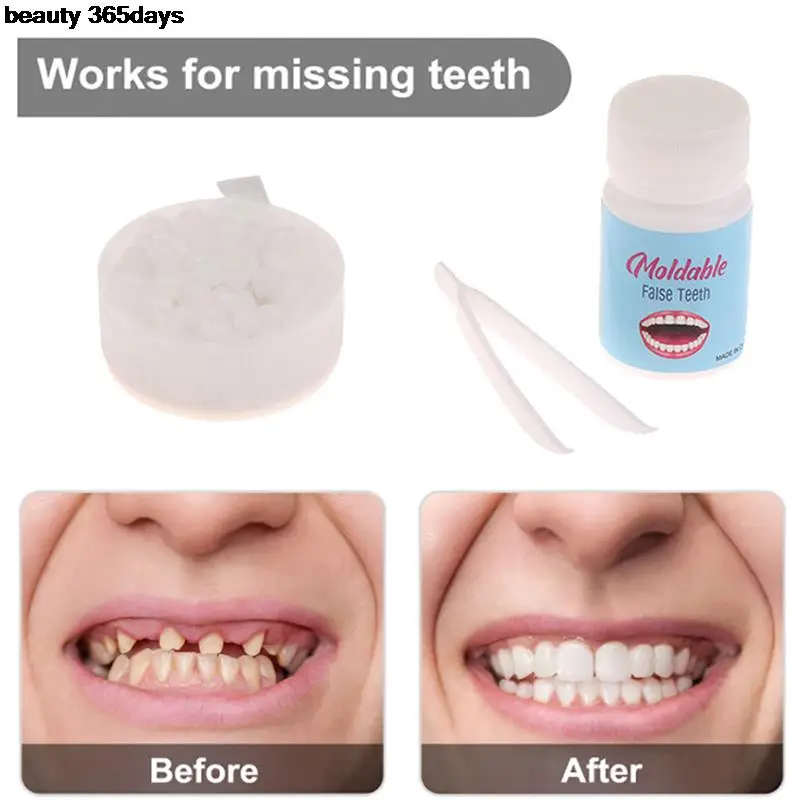 

Смола 10 г/15 г/20 г зубы и зазоры FalseTeeth твердый клей набор для временного ремонта зубов клей для зубов отбеливание зубов