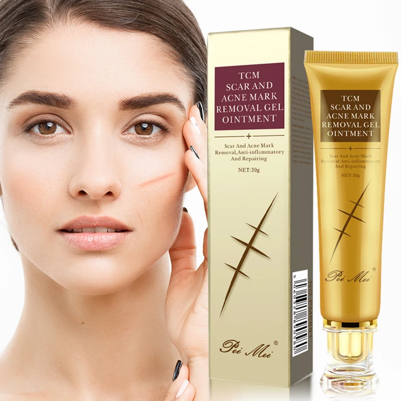 Acne Scar Removal Repair Cream Treatment Acne Stretch Marks Pimples Spots Gel Whitening Moisturizing Smoothing Body Skin Care
Acne Scar Removal Repair Cream Treatment Acne Stretch Marks Pimples Spots Gel Whitening Moisturizing Smoothing Body Skin Care